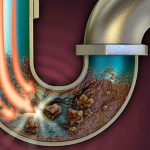 لوله بازکنی اشرفی اصفحانی